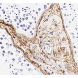 Ropporin-1-Like Protein (ROPN1L) Antibody