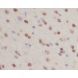 RAR Related Orphan Receptor Beta (RORB) Antibody