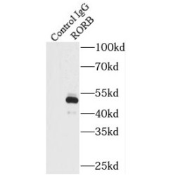 RAR Related Orphan Receptor Beta (RORB) Antibody