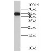 WB analysis of Y79 cells, using RORB antibody (1/800 dilution).