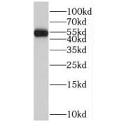 WB analysis of Y79 cells, using RORB antibody (1/800 dilution).