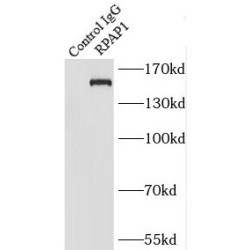 RNA Polymerase II Associated Protein 1 (RPAP1) Antibody