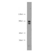 WB analysis of Y79 cells, using RPE65 antibody (1/600 dilution).