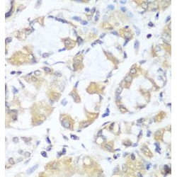 Rabphilin-3A-Like Protein (RPH3AL) Antibody