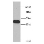 WB analysis of HeLa cells, using RPL13 antibody (1/1000 dilution).