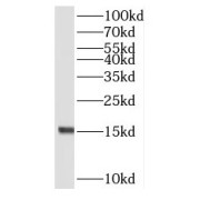 WB analysis of HeLa cells, using RPL23 antibody (1/200 dilution).