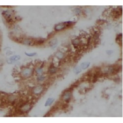 Ribosomal Protein L7 (RPL7) Antibody