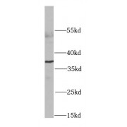 WB analysis of HeLa cells, using RPLP0 antibody (1/1000 dilution).