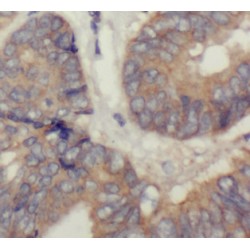 Ribosomal Protein Lateral Stalk Subunit P0 (RPLP0) Antibody