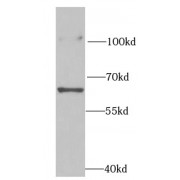 WB analysis of HeLa cells, using RPN2 antibody (1/1000 dilution).