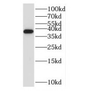 WB analysis of rat kidney tissue, using RPP38 antibody (1/600 dilution).