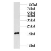 WB analysis of HeLa cells, using RPS16 antibody (1/500 dilution).