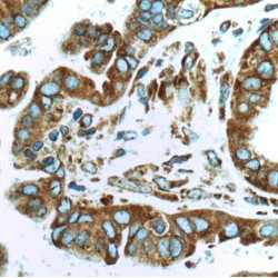 Ribosomal Protein S29 (RPS29) Antibody