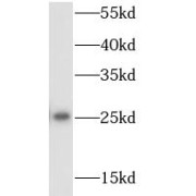 WB analysis of mouse uterus tissue, using RPS9 antibody (1/500 dilution).
