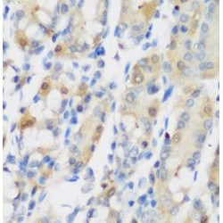 Ribonucleoside-Diphosphate Reductase Large Subunit (RRM1) Antibody