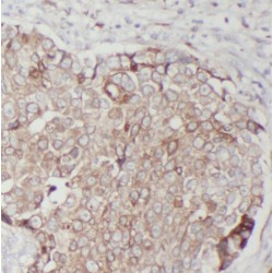 Ribonucleoside-Diphosphate Reductase Large Subunit (RRM1) Antibody