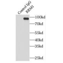 Ribonucleoside-Diphosphate Reductase Large Subunit (RRM1) Antibody