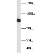WB analysis of K-562 cells, using RRM1 antibody (1/1000 dilution).