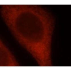 S-Adenosylmethionine-Dependent Nucleotide Dehydratase RSAD2 (RSAD2) Antibody