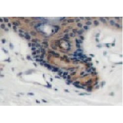 S-Adenosylmethionine-Dependent Nucleotide Dehydratase RSAD2 (RSAD2) Antibody