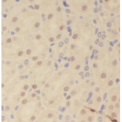 Ribosomal Protein S6 Kinase Alpha-3 (RPS6KA3) Antibody