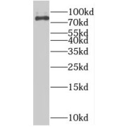 WB analysis of NIH/3T3 cells, using RSK3 antibody (1/300 dilution).