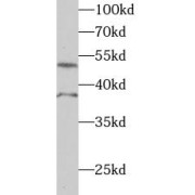 WB analysis of HeLa cells, using RSRC1 antibody (1/1000 dilution).