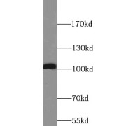 WB analysis of HeLa cells, using RTN3 antibody (1/500 dilution).