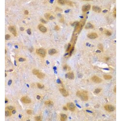 RUN And FYVE Domain Containing 1 (RUFY1) Antibody