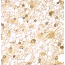 RUN And FYVE Domain Containing 2 (RUFY2) Antibody