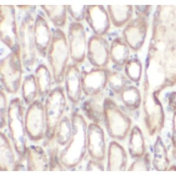 Tyrosine-Protein Kinase RYK (RYK) Antibody