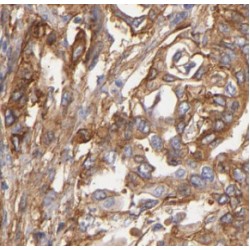 Protein S100-A10 (S100A10) Antibody