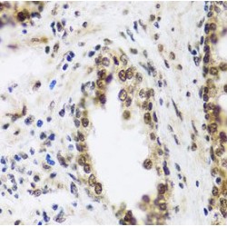 Scaffold Attachment Factor B2 (SAFB2) Antibody