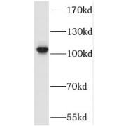 WB analysis of HEK-293 cells, using SALL2 antibody (1/300 dilution).