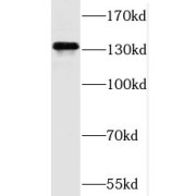 WB analysis of HeLa cells, using SAPS3 antibody (1/500 dilution).