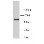 WB analysis of HEK-293 cells, using SARS antibody (1/1000 dilution).
