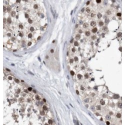 Squamous Cell Carcinoma Antigen Recognized By T-Cells 3 (SART3) Antibody