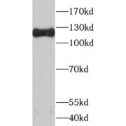 abx237612