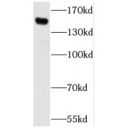 WB analysis of Jurkat cells, using SBNO1 antibody (1/600 dilution).