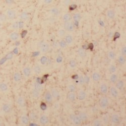 Secretory Carrier-Associated Membrane Protein 1 (SCAMP1) Antibody