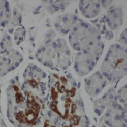 Secretory Carrier-Associated Membrane Protein 2 (SCAMP2) Antibody