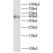 WB analysis of HepG2 cells, using SCAMP2 antibody (1/500 dilution).