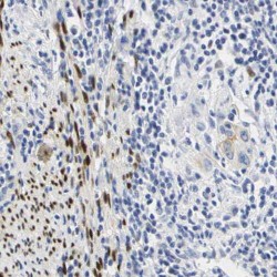 Sciellin (SCEL) Antibody