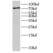 WB analysis of A431 cells, using SCEL antibody (1/300 dilution).