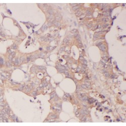 Sec1 Family Domain Containing 2 (SCFD2) Antibody