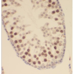 Sex Comb On Midleg Like 2 (Drosophila) (SCML2) Antibody