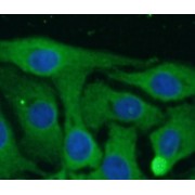 IF analysis of SH-SY5Y cells, using SCN10A antibody (1/25 dilution).