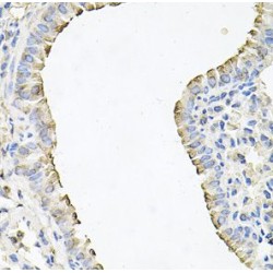 Amiloride Sensitive Sodium Channel Subunit Gamma (SCNN1G) Antibody