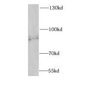 WB analysis of mouse lung tissue, using SCNN1G antibody (1/1200 dilution).