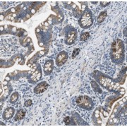 IHC-P analysis of human intestine tissue, using SDR42E1 antibody (1/50 dilution).